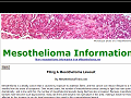 Filing A Mesothelioma Lawsuit
